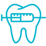 Endodoncia--Dentista-en-Plasencia